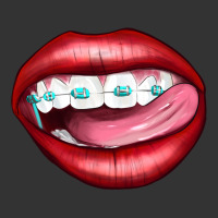 Lips Dental Braces | Teevron