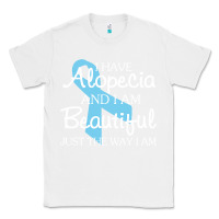 White I Have Alopecia Awareness, I Am Beautiful Just Th Classic Tee - longCreatives