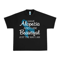 I Have Alopecia Awareness, I Am Beautiful Just Th Urban Heavy Tee | Teevron