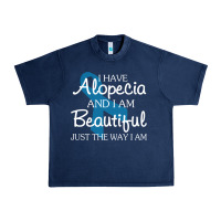 Navy I Have Alopecia Awareness, I Am Beautiful Just Th Urban Heavy Tee - longCreatives